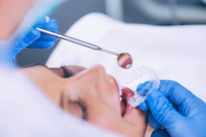 teeth whitening procedure FPUEZLH 1